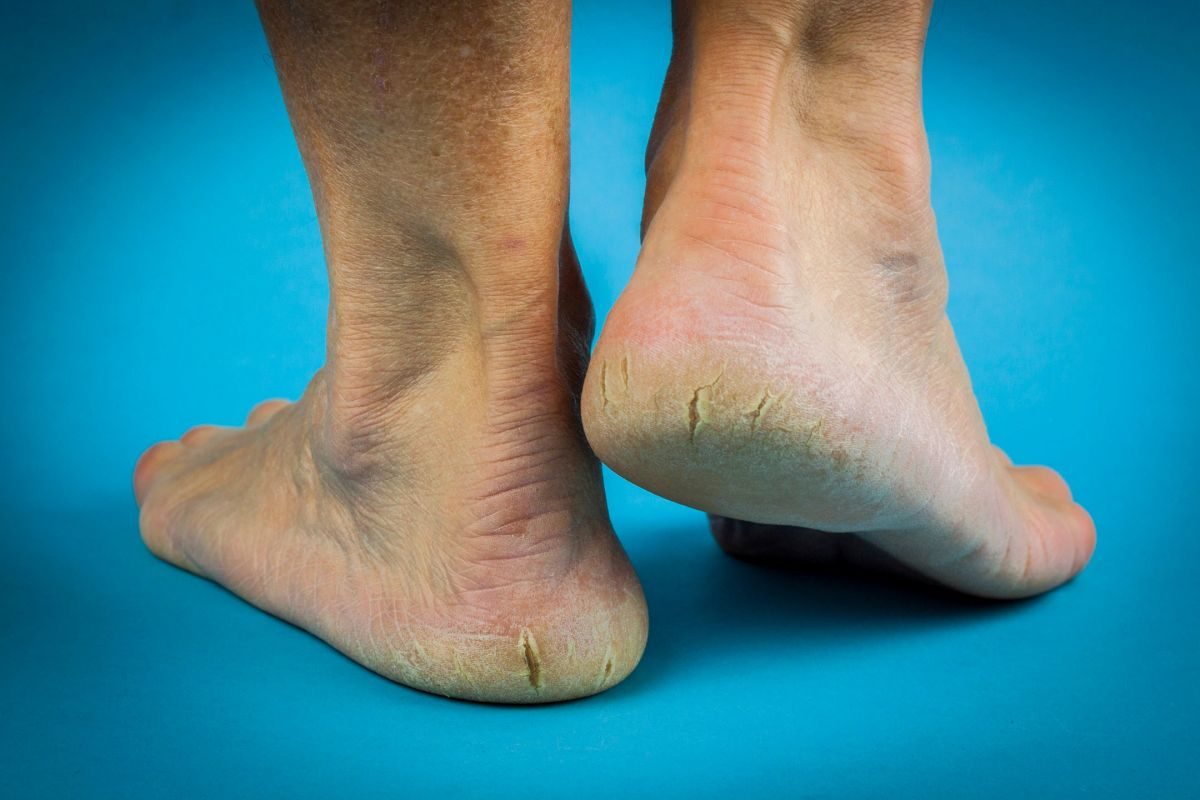Pedicure Perfection: Foot Care Tips for Oil and Gas Worker Guyana